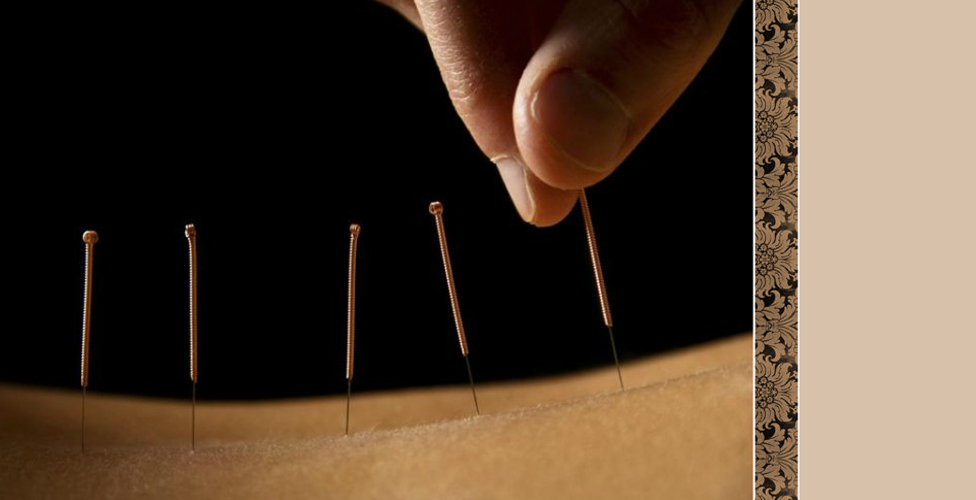 Acupuncture Columbia SC Blue Root Health